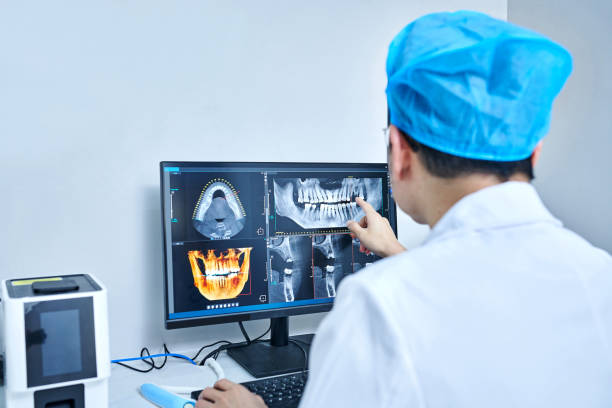 Best Emergency Dental Care for Broken or Chipped Teeth in Hidden Valley Lake, CA